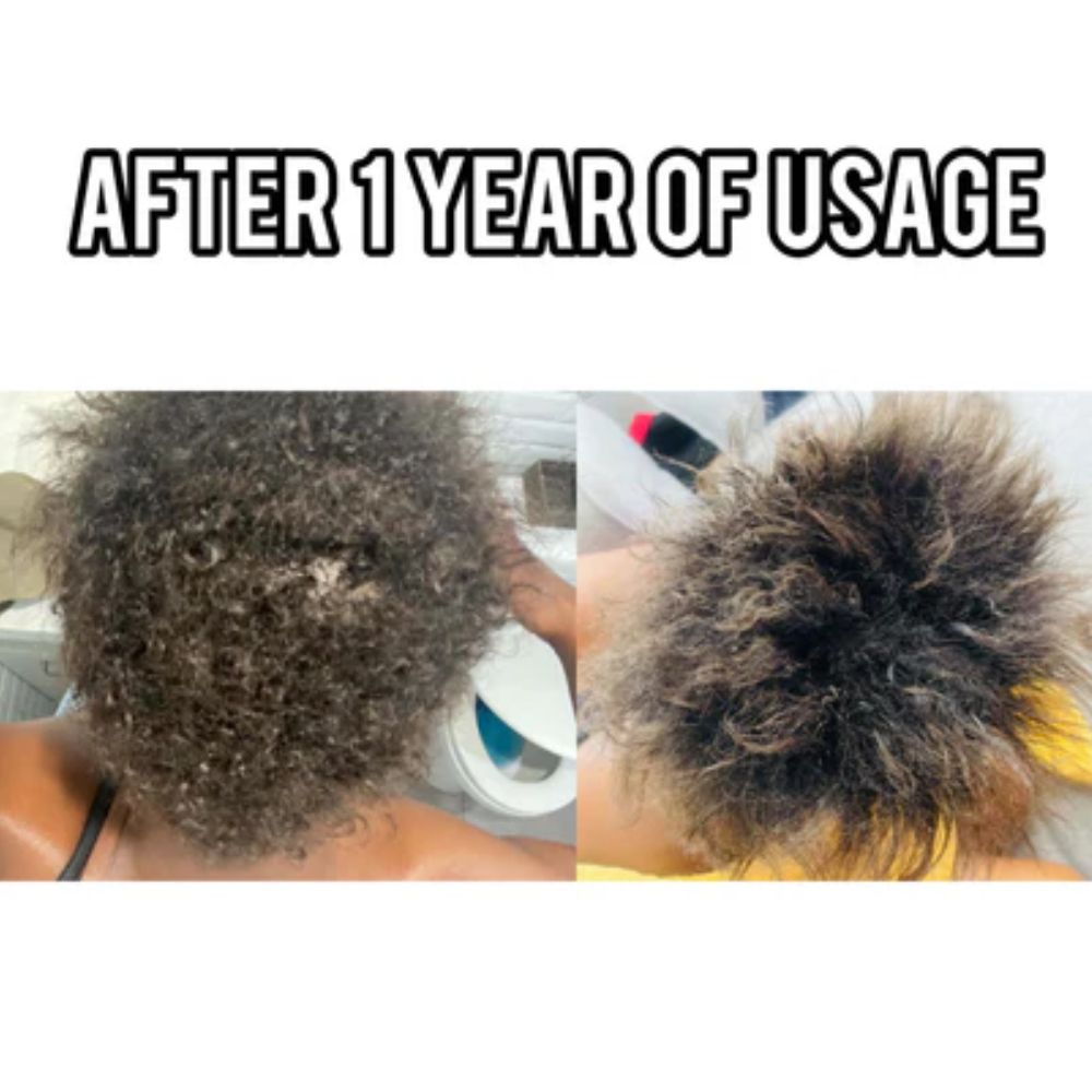 Thicker, Stronger Hair Growth Bundle